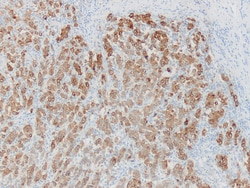 Newcomer Supply Melan-A (MART-1) Control Slides, 10/set, Quantity: Pack