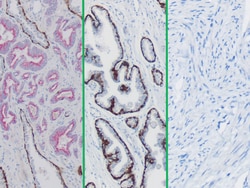 Newcomer Supply CK5/14 + p63 + P504S (PIN-4), Multi-Tissue Control Slides,