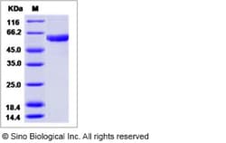 Sino Biological Influenza A H9N2 (A/duck/Hong Kong/448/78) Hemagglutinin