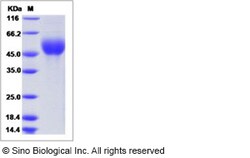 Sino Biological Influenza A H9N2 (A/duck/Hong Kong/448/78) Hemagglutinin