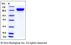 Sino Biological Influenza A H1N1 (A/Texas/05/2009) Hemagglutinin / HA Protein