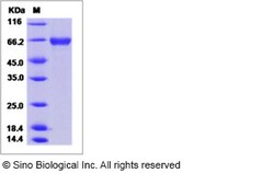 Sino Biological Influenza A H1N1 (A/New York/18/2009) Hemagglutinin / HA