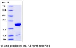 Sino Biological Influenza A H1N1 (A/Puerto Rico/8/34/Mount Sinai) Matrix
