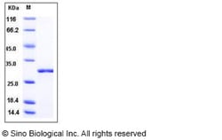 Sino Biological Influenza A H1N1 (A/Puerto Rico/8/34/Mount Sinai) Non-structural