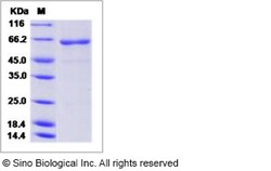 Sino Biological Influenza A H5N1 (A/hubei/1/2010) Hemagglutinin / HA Protein