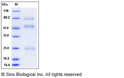 Sino Biological Influenza A H5N1 (A/Hubei/1/2010) Hemagglutinin / HA Protein