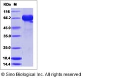 Sino Biological Influenza B (B/Brisbane/60/2008) Hemagglutinin / HA Protein