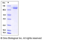 Sino Biological Influenza B (B/Brisbane/60/2008) Hemagglutinin / HA Protein
