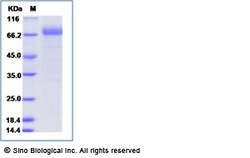 Sino Biological Influenza B (B/Brisbane/60/2008) Hemagglutinin / HA Protein