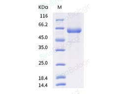 Sino Biological Human coronavirus HKU1 (isolate N1) (HCoV-HKU1) Spike S2