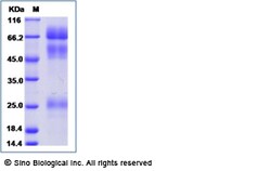 Sino Biological Influenza A H5N1 (A/Vietnam/UT31413II/2008) Hemagglutinin