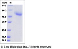 Sino Biological Influenza A H5N1 (A/goose/Guangdong/1/1996) Hemagglutinin