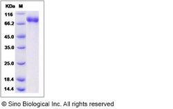 Sino Biological Influenza A H5N1 (A/Cambodia/S1211394/2008) Hemagglutinin