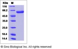 Sino Biological Influenza A H10N9 (A/duck/Hong Kong/562/1979) Hemagglutinin