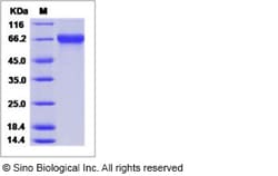 Sino Biological Influenza A H12N1 (A/mallard duck/Alberta/342/1983) Hemagglutinin