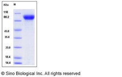 Sino Biological Influenza A H12N1 (A/mallard duck/Alberta/342/1983) Hemagglutinin