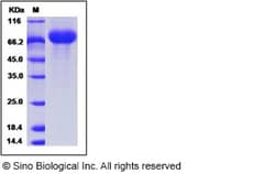 Sino Biological Influenza A H9N2 (A/chicken/Hong Kong/G9/1997) Neuraminidase