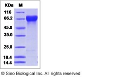 Sino Biological Influenza A H3N2 (A/Perth/16/2009) Hemagglutinin / HA-specific