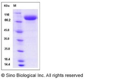 Sino Biological Influenza A H3N2 (A/Perth/16/2009) Hemagglutinin / HA Protein