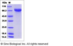Sino Biological Influenza A H3N2 (A/Victoria/210/2009) Hemagglutinin /
