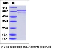 Sino Biological Influenza A H3N2 (A/X-31) Hemagglutinin / HA Protein (His