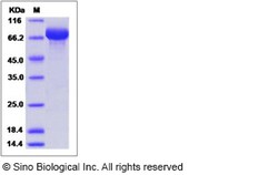 Sino Biological Influenza A H3N2 (A/X-31) Hemagglutinin / HA Protein (His