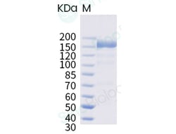 Sino Biological MERS-CoV Spike S1+S2 Protein (ECD, aa 1-1297, His Tag),