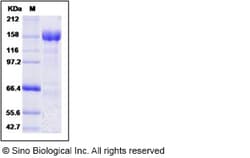 Sino Biological MERS-CoV Spike Protein (S1+S2 ECD, aa 1-1297, His Tag),