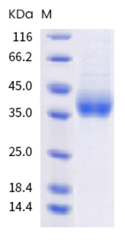 Sino Biological MERS-CoV Spike Protein 20ug (Sino Biological), Quantity:
