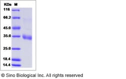 Sino Biological MERS-CoV Spike/RBD Protein fragment (RBD, aa 367-606, His