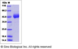 Sino Biological Ebola virus EBOV (Subtype Sudan, strain Gulu) Glycoprotein