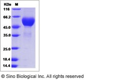 Sino Biological Influenza A H3N2 (A/Memphis/1/1968) Hemagglutinin / HA1