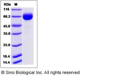 Sino Biological Influenza A H7N9 (A/Pigeon/Shanghai/S1069/2013) Hemagglutinin
