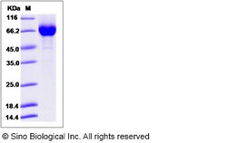 Sino Biological Influenza A H7N9 (A/Anhui/1/2013) Neuraminidase / NA (His