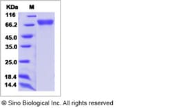 Sino Biological Influenza A H3N2 (A/Fujian/411/2002) Hemagglutinin / HA