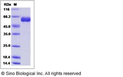 Sino Biological Influenza A H7N9 (A/Zhejiang/1/2013) Hemagglutinin / HA