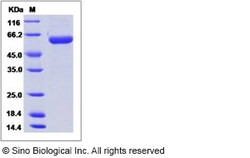 Sino Biological Influenza A H7N9 (A/Shanghai/4664T/2013) Hemagglutinin