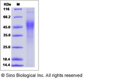 Sino Biological Influenza A H7N3 (A/chicken/SK/HR-00011/2007) Hemagglutinin