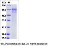 Sino Biological Influenza A H1N1 (A/Taiwan/01/1986) Hemagglutinin / HA
