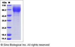 Sino Biological Influenza A H1N1 (A/Texas/36/1991) Hemagglutinin Protein