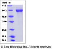 Sino Biological Influenza A H1N1 (A/Beijing/262/1995) Hemagglutinin / HA