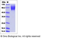 Sino Biological Influenza A H1N1 (A/Beijing/262/1995) Hemagglutinin / HA1