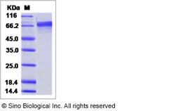 Sino Biological Influenza A H3N1 (A/swine/Korea/PZ72-1/2006) Hemagglutinin