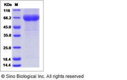 Sino Biological Influenza A H3N1 (A/swine/Korea/PZ72-1/2006) Hemagglutinin