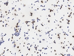 Sino Biological SARS-CoV / SARS-CoV-2 Nucleocapsid Antibody, Chimeric MAb