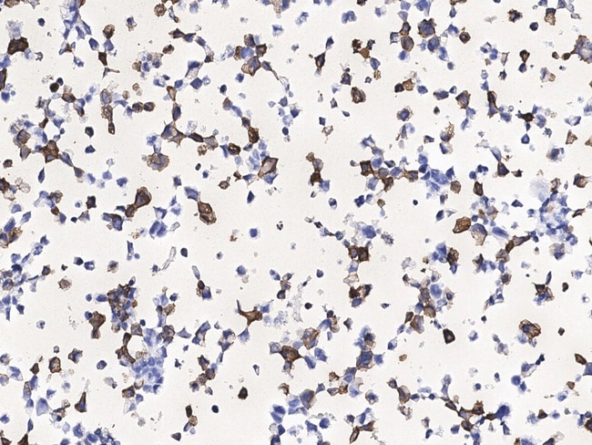 Sino Biological SARS-CoV / SARS-CoV-2 Nucleocapsid Antibody, Chimeric ...