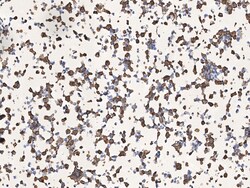 Sino Biological SARS-CoV-2 (2019-nCoV) Nucleocapsid Antibody, Rabbit MAb,
