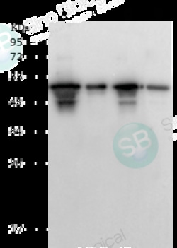 Sino Biological SARS-CoV / SARS-CoV-2 Nucleocapsid Antibody, Rabbit PAb,