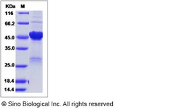 Sino Biological SARS-CoV Nucleocapsid Protein (His Tag), Quantity: Each