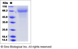 Sino Biological Influenza A H3N2 (A/Wisconsin/15/2009) Hemagglutinin /